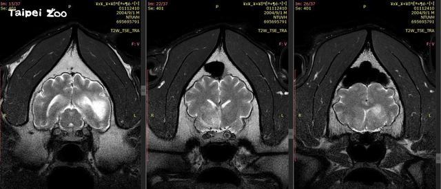 大熊猫“团团”疑有恶性肿瘤 用脚拖行前进让人心疼