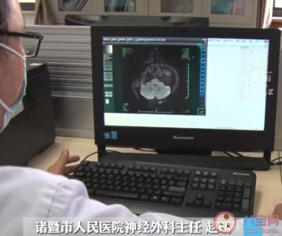 女子饭店吃饭被陌生医生提醒患病是怎么回事 垂体瘤的病因是什么