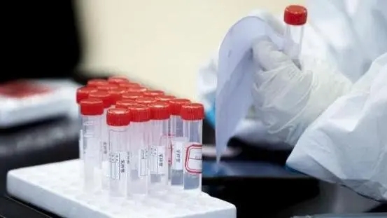 北京新增本土747+3560 社会面806例