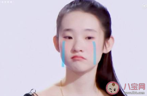泪失禁体质是什么意思 泪失禁体质有多能哭