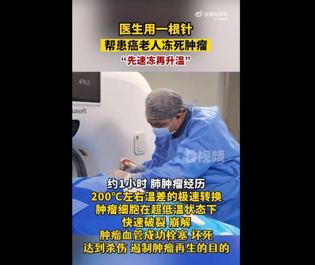 医生用一根针帮患癌老人冻死肿瘤 神奇氩氦刀技术